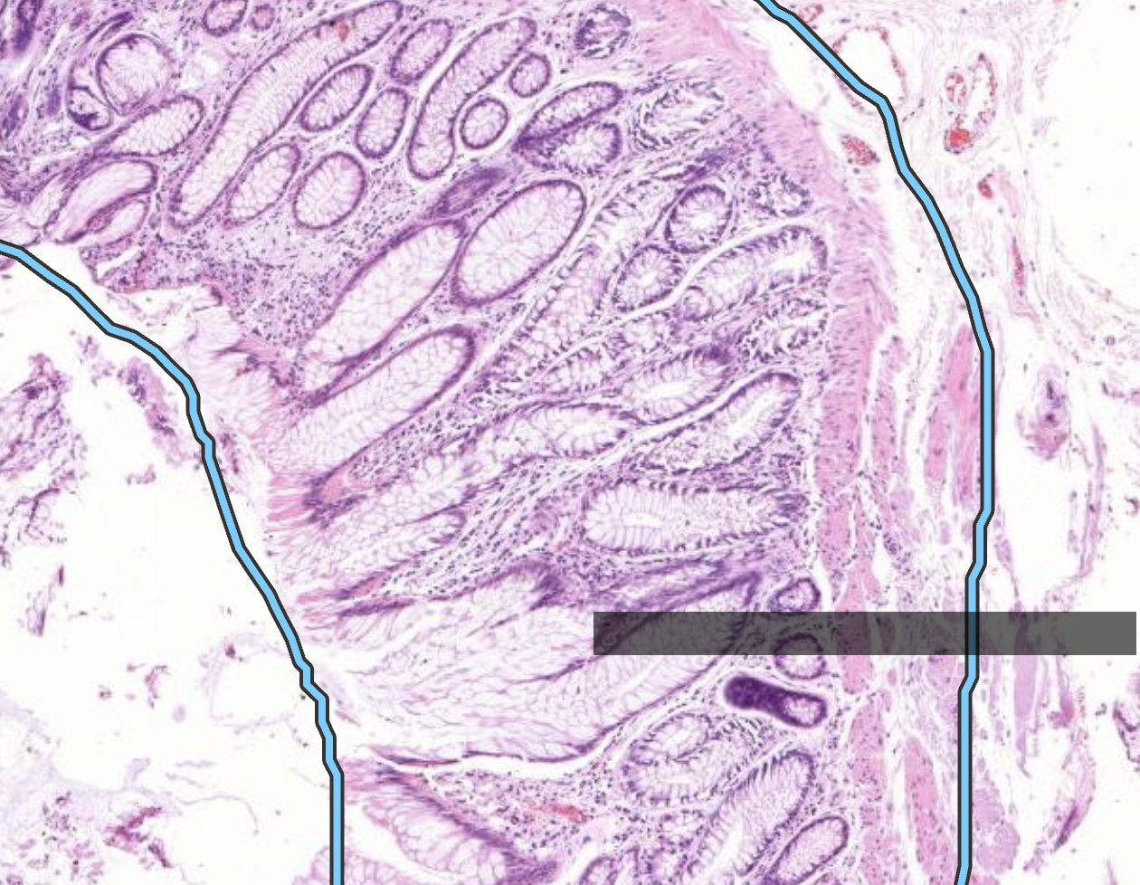 Histopathologisches Bild: Kolonschleimhaut